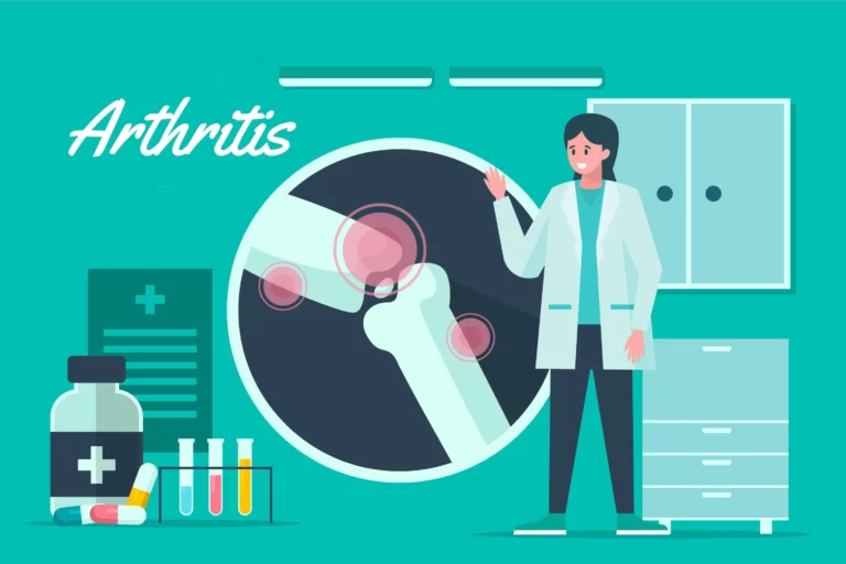 Arthritis