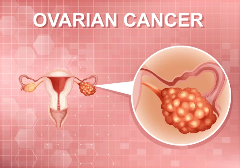 Ovarian websites